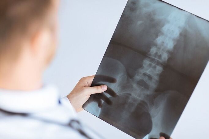 Diagnostinės juosmens osteochondrozės parinktys