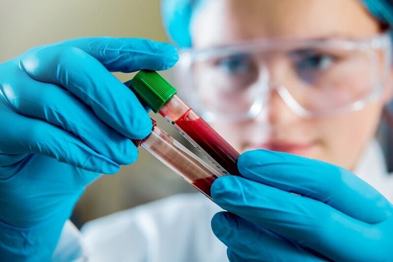 Pilnas kraujo tyrimas diagnozuoti juosmens skausmą